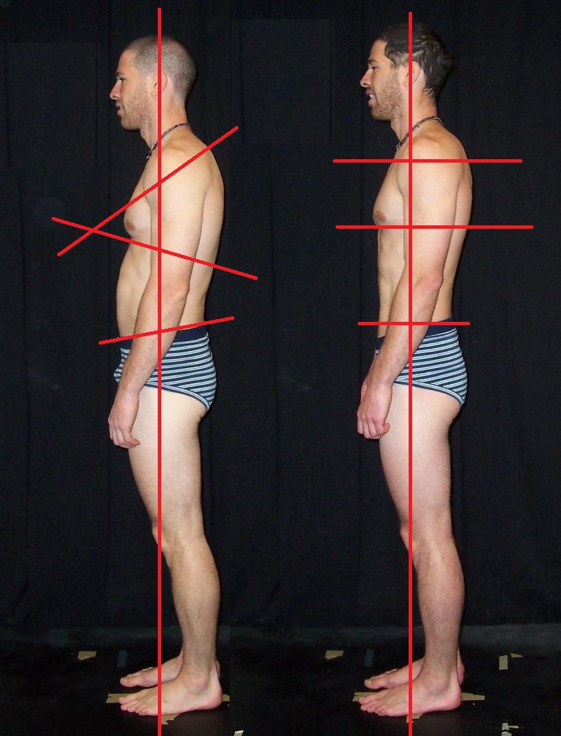 Rolfing before and after 10-series 